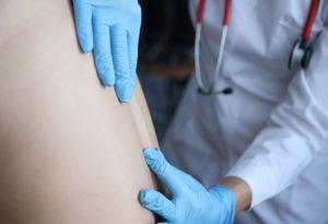 prevenir hernia discal en Pamplona